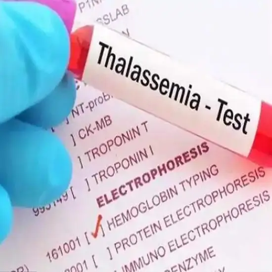 thalassemia profile health package